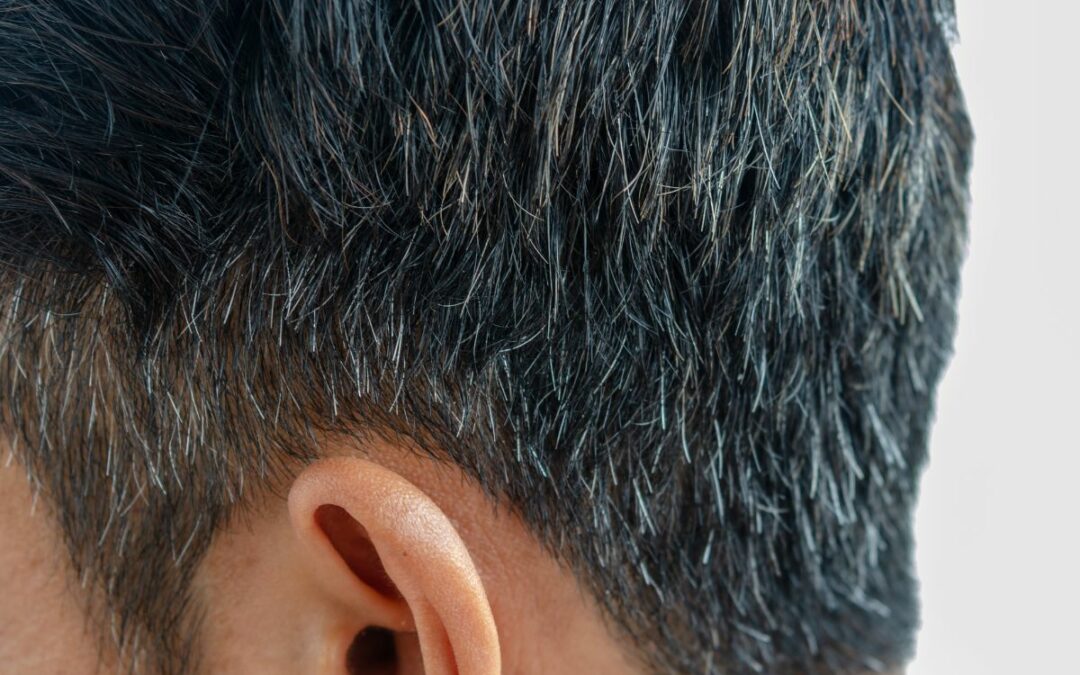 Eliminare i capelli bianchi senza tinta: come fare?