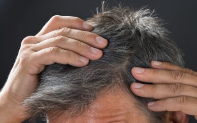 Capelli bianchi e alimentazione: che legame c’è?